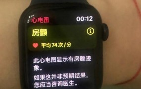 为什么说千万不要开启iWatch心电图功能？